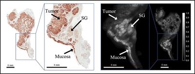 Fluorescence molecular optomic signatures improve identification of tumors in head and neck specimens